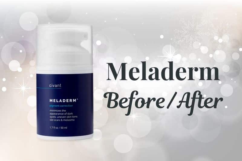 Meladerm Before and After